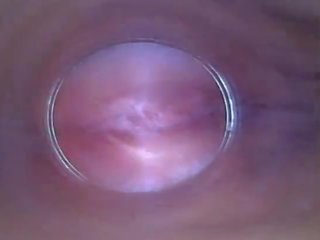 Solo e imët vajzë afër lart vë endoscope në thithka përdor aparat fotografik si dildo